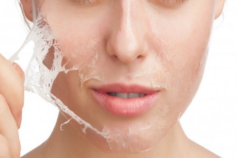 Tùy vào tình trạng da mà chỉ định peel da sẽ khác nhau