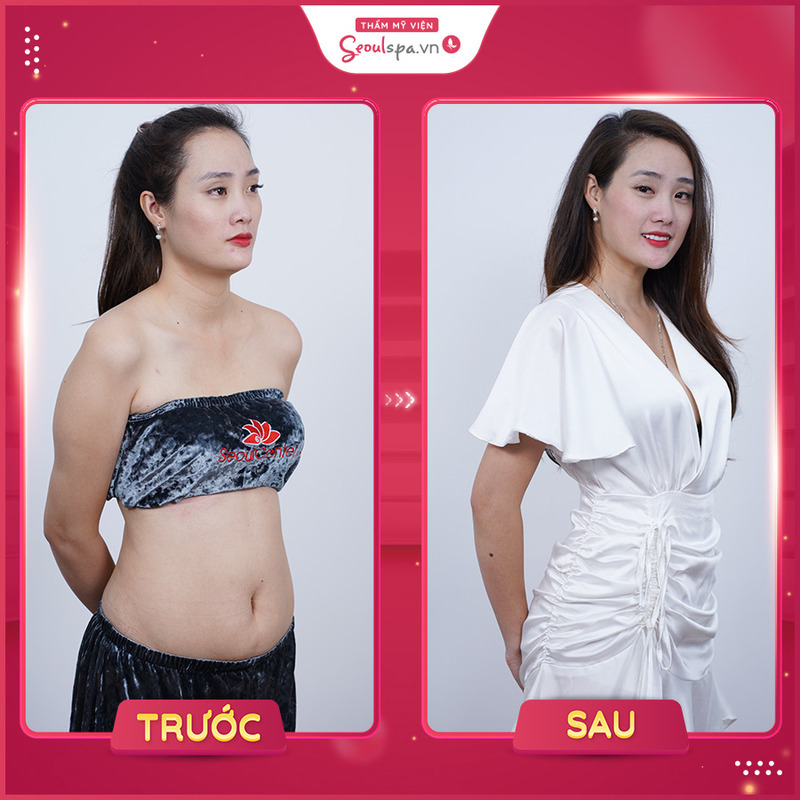 Top 20+ 1 Cây Lạp Xưởng Bao Nhiêu Calo Lạp xưởng bao nhiêu calo? Ăn lạp xưởng có béo không? 39 Kết quả sau điều trị tại Seoul Spa