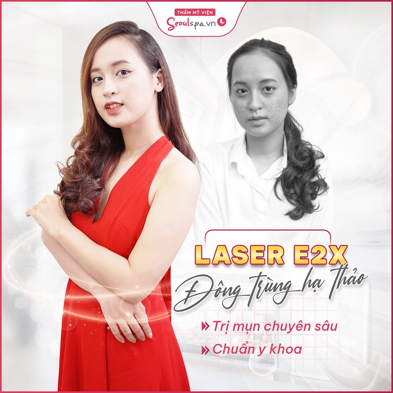 Phương pháp điều trị mụn tận gốc, trả lại làn da mịn màn cho chị em