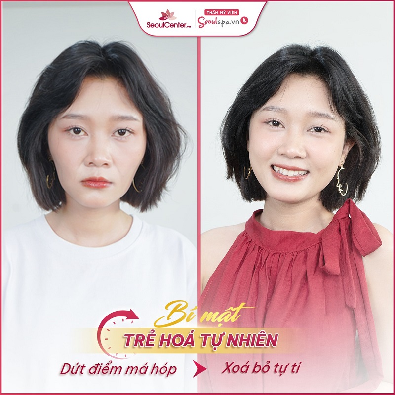 Top 20+ Khoa Thẩm Mỹ Bệnh Viện Da Liễu Quy Nhơn Top 6 địa chỉ Thẩm mỹ viện uy tín ở Quy Nhơn - Seoul Spa 49 SeoulSpa.Vn Quy Nhơn sở hữu nhiều dịch vụ làm đẹp cao cấp với hiệu quả vượt trội