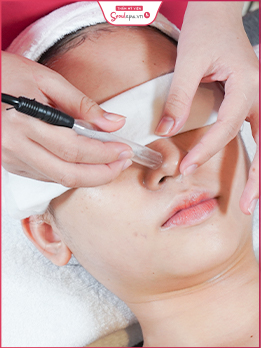 dịch vụ DR.Seoul trị và ức chế mụn VAS 4.0 cho da mụn và nhạy cảm