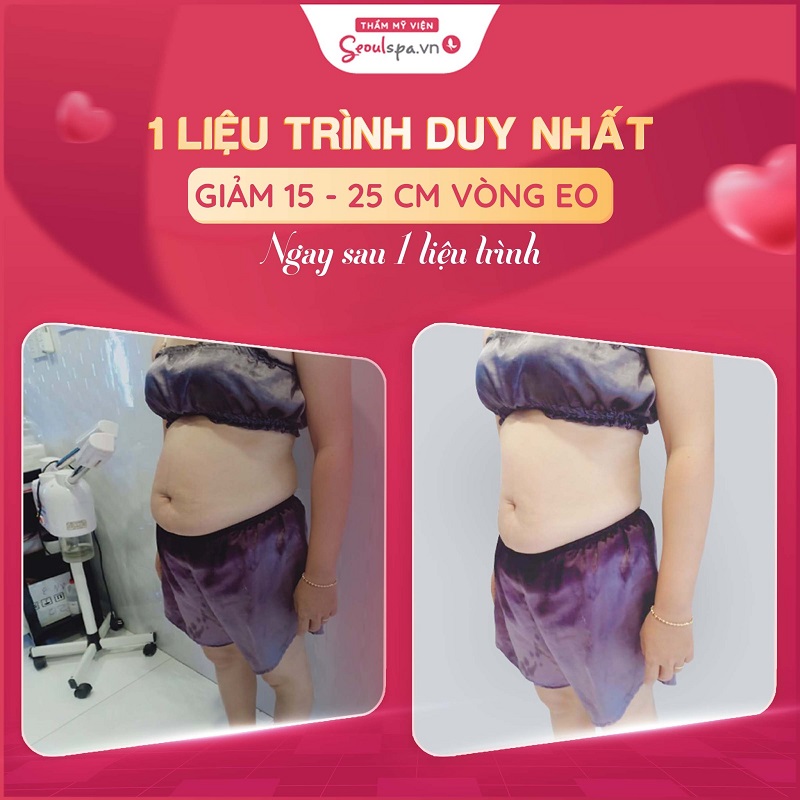Top 20+ Bánh Cốm Hà Nội Bao Nhiêu Calo Bánh giò bao nhiêu calo? Ăn bánh giò có tăng cân không? 36 Kết quả sau liệu trình giảm cân tại spa Seoul