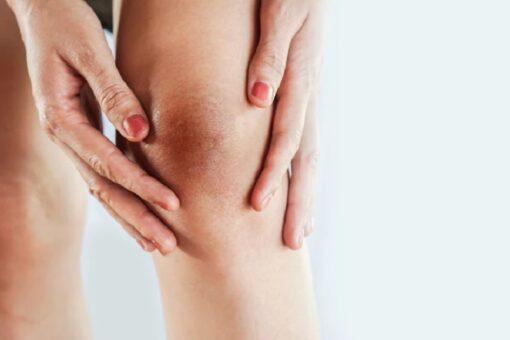 Chỉ số BMI giúp đánh giá tình trạng cân nặng của cơ thể