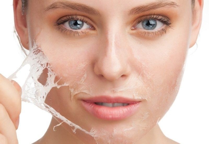 Top 20+ Học Trò Hư Đòi Tắm Chung Với Nữ Gia Sư Peel da trị thâm mụn có thật sự hiệu quả? Những lưu ý cần nhớ 25 Tẩy tế bào chết để loại bỏ vết thâm và trả lại làn da mịn màng