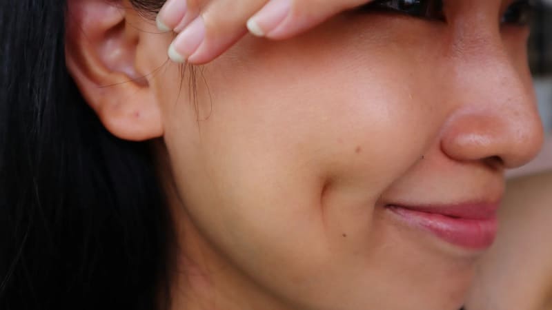 Top 20+ Nhạt Miệng Có Phải Dấu Hiệu Mang Thai Tạo má lúm đồng tiền có vĩnh viễn không? - Seoul Spa 21 Lúm đồng tiền là nét duyên tinh tế, khiến người phụ nữ trở nên quyến rũ hơn