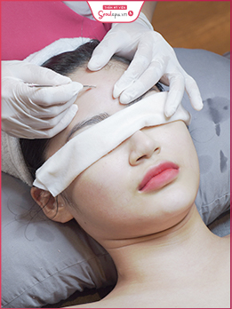dịch vụ trị mụn y khoa