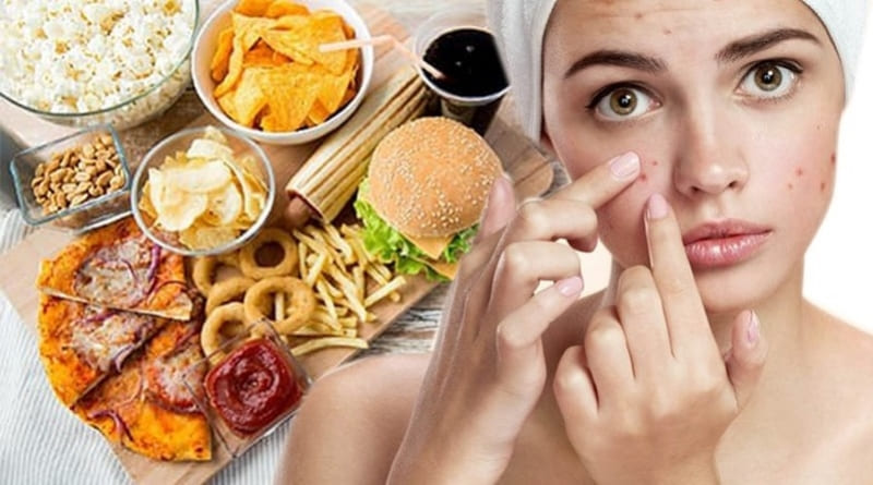 Top 20+ Mụn Mọc Ở Tai Có Nguy Hiểm Không Mụn trong lỗ mũi: Nguyên nhân và cách khắc phục đơn giản 49 Chế độ dinh dưỡng không lành mạnh cũng là nguyên nhân gây mụn