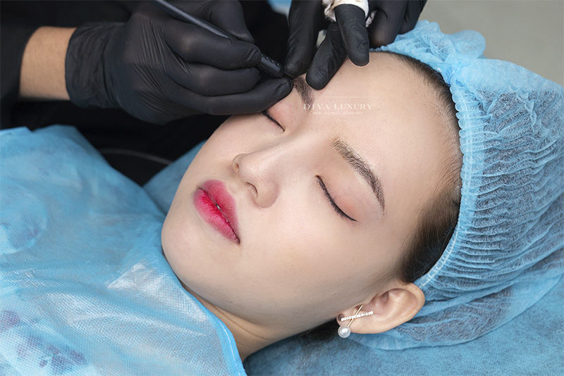 Chi phí thực hiện nâng cung mày từ 7 đến 18 triệu đồng