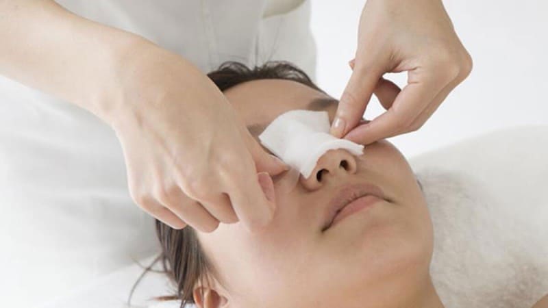Chăm sóc đúng theo chỉ dẫn sau nâng mũi để vết thương nhanh hồi phục và đạt được kết quả thẩm mỹ như mong đợi