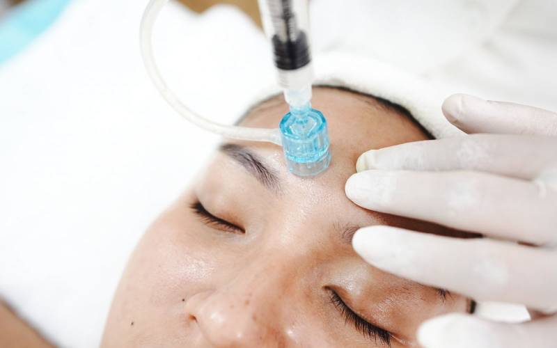 Cấy Siêu Vi Điểm Max Collagen tái tạo da từ sâu bên trong lớp biểu bì