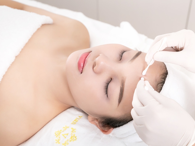 Việc tự ý nặn mụn tại nhà có thể khiến tình trạng mụn nặng hơn