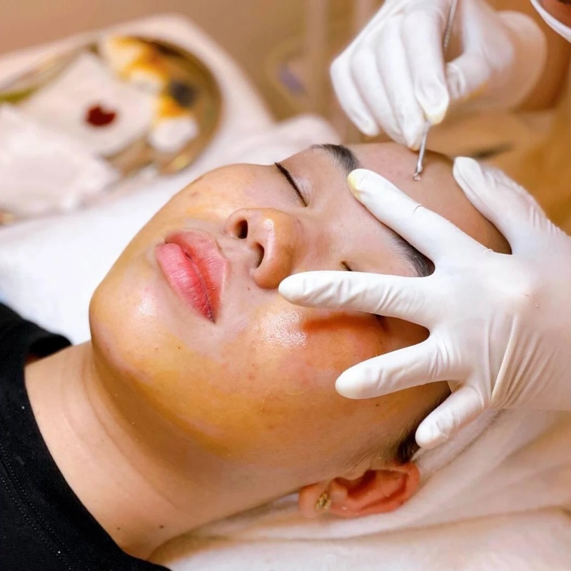 Cơ sở điều trị mụn có được trang bị đầy đủ trang thiết bị, công nghệ hiện đại cũng quyết định đến lấy nhân mụn giá bao nhiêu