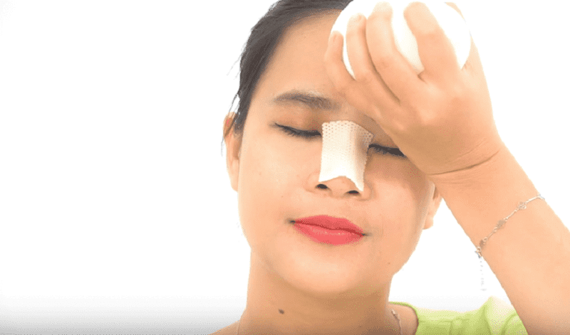 Chườm đá giúp bớt sưng tấy vùng vết thương mới phẫu thuật