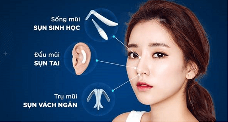 Từng bộ phận của mũi bác sĩ sẽ linh hoạt sử dụng các loại sụn khác nhau