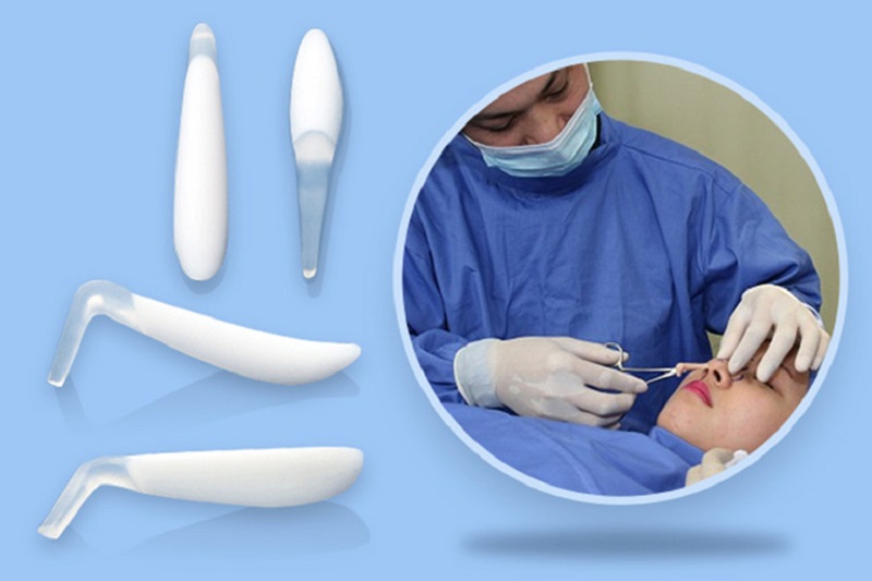 Sụn Silicon thường được dùng trong nâng mũi cấu trúc 4D