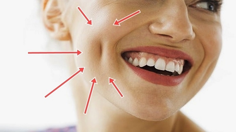 Sở hữu má lúm duyên dáng cho nụ cười thêm rạng rỡ