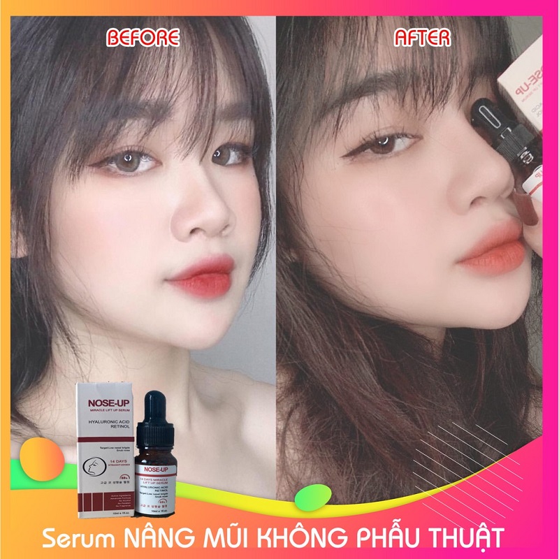 Serum nâng mũi Nose Up có xuất xứ từ hàng, là loại phổ biến nhất hiện nay