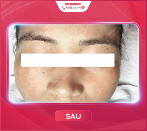 Phòng trị liệu được sắp xếp ngăn nắp, gọn gàng, tiện nghi giúp khách hàng có không gian riêng tư mỗi khi sử dụng dịch vụ