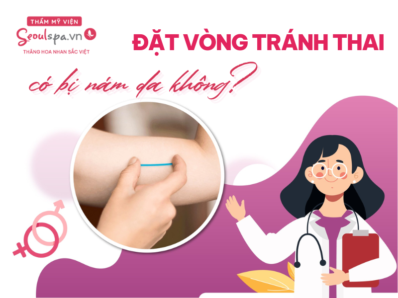 Cấy que tránh thai có bị nám da không?