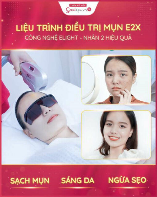 Phun môi đẹp tại Thẩm mỹ viện SeoulSpa.Vn