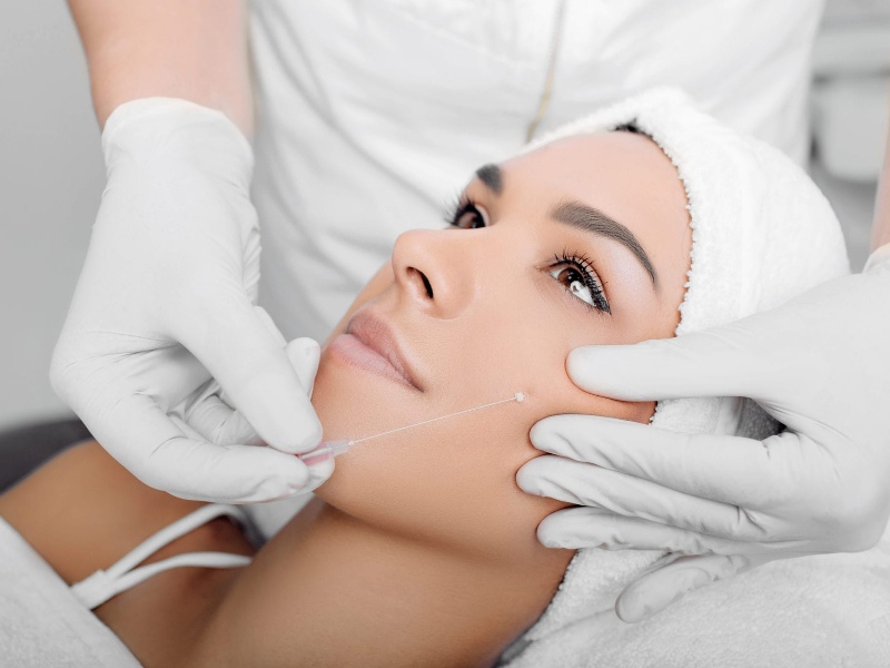 Top 20+ Cấy Mỡ Mặt Bao Lâu Hết Sưng Căng chỉ collagen bao lâu thì hết sưng? Chăm sóc da sau căng chỉ 15 Căng chỉ collagen bao lâu thì hết sưng?