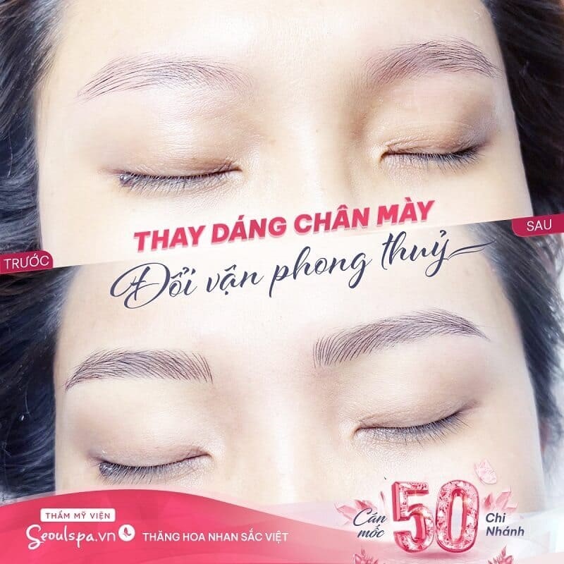Lựa chọn Thẩm mỹ viện SeouSpa.Vn khắc phục lông mày đứt đoạn với công nghệ cao