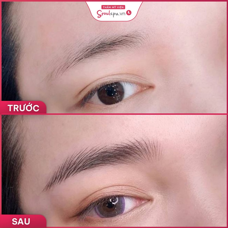 Top 20+ Thẩm Mỹ Viện Kim Chi Bình Dương TOP 10 Spa - Thẩm mỹ viện phái đẹp nên biết tại Bình Dương 70 Sở hữu đôi mí sắc nét và hài hòa với tổng thể gương mặt tại SeoulSpa.Vn