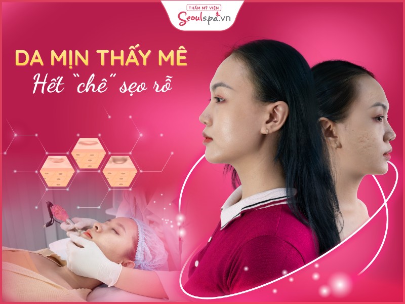 Top 20+ Thẩm Mỹ Viện Bắc Âu Có Tốt Không TOP 10 Spa - Thẩm mỹ viện uy tín, chất lượng hàng đầu ở Buôn Ma Thuột 74 Trị sẹo rỗ bằng công nghệ Dr. Seoul mới và hiện đại nhất