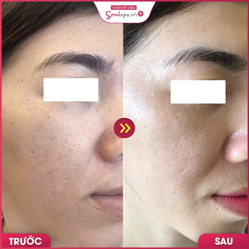 Top 20+ Thẩm Mỹ Viện Bắc Âu Có Tốt Không TOP 10 Spa - Thẩm mỹ viện uy tín, chất lượng hàng đầu ở Buôn Ma Thuột 75 Điều trị sẹo dứt điểm tại SeoulSpa.Vn Buôn Ma Thuột