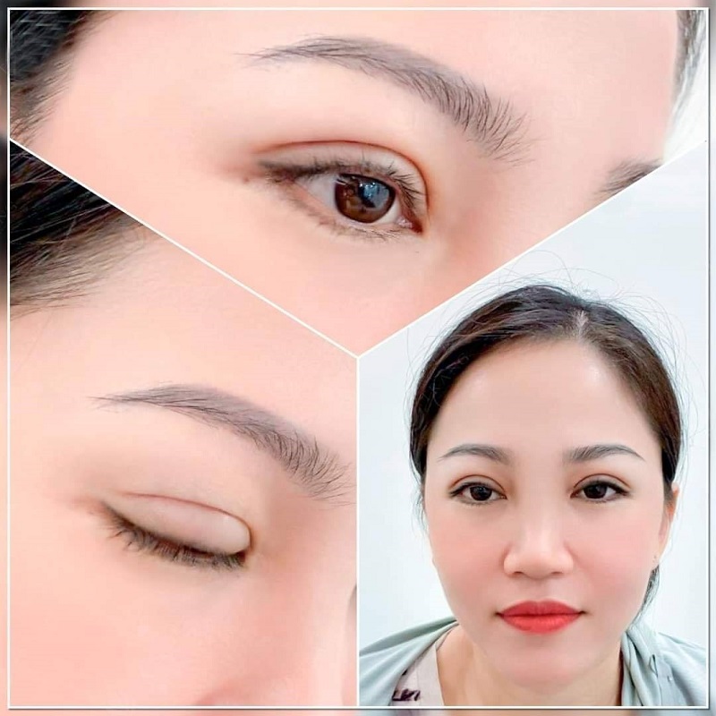 Top 20+ Thẩm Mỹ Viện Bắc Âu Có Tốt Không TOP 10 Spa - Thẩm mỹ viện uy tín, chất lượng hàng đầu ở Buôn Ma Thuột 94 Kết quả của khách hàng khi thực hiện dịch vụ tại Thẩm mỹ viện Chợ Rẫy