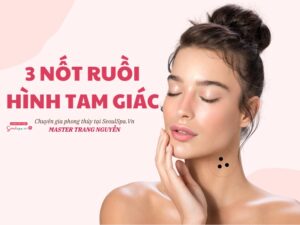 3 nốt ruồi hình tam giác
