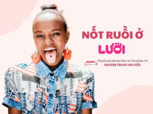 Nốt ruồi ở lưỡi