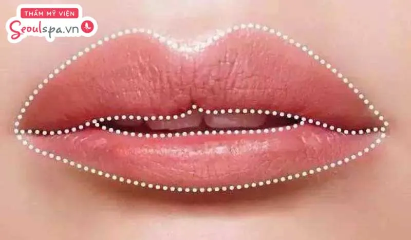 Môi trên dày và to hơn môi dưới là một trong những đặc điểm có thể ảnh hưởng đến sự mất cân đối khuôn mặt