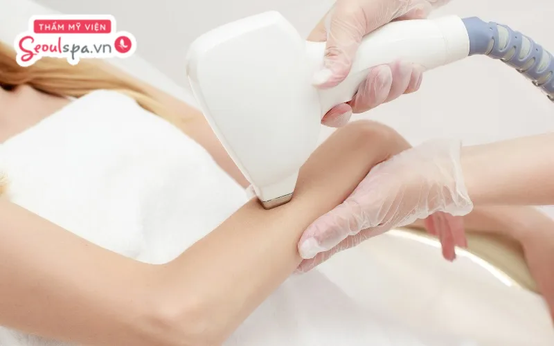 Có thể triệt lông không dùng gel lạnh nhưng tiềm ẩn nhiều nguy cơ đau rát trong quá trình thực hiện