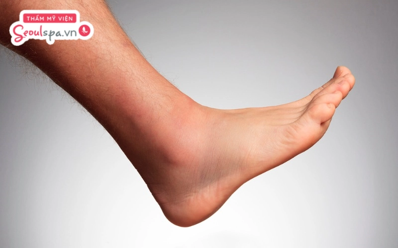 Tránh gãi hoặc tác động ngoại lực lên bề mặt da sau khi triệt lông vì dễ tạo điều kiện để vi khuẩn tấn công nang lông