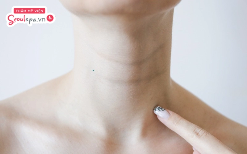 Nốt ruồi xanh nằm trên cổ được cho là dấu hiệu của người có tính cách nóng nảy và không mấy tích cực