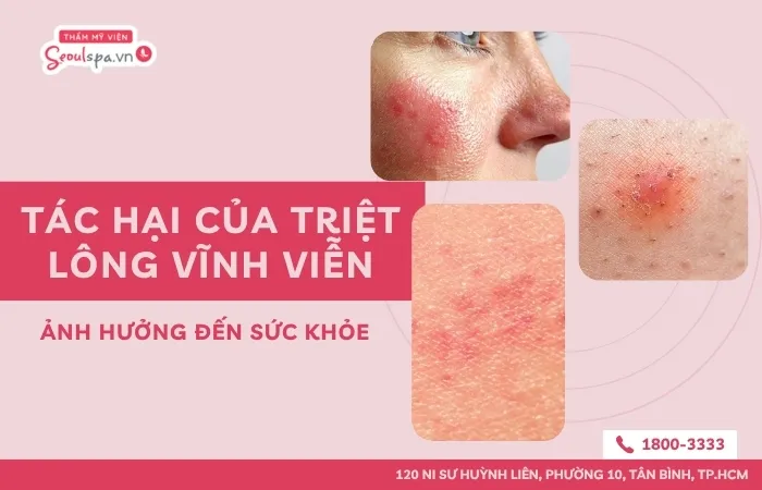 8 tác hại của triệt lông vĩnh viễn ảnh hưởng đến sức khỏe