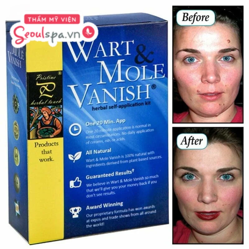 Wart and Mole Vanish là sản phẩm xóa nốt ruồi chất lượng và cao cấp được sản xuất tại Mỹ với hiệu quả làm mờ nốt ruồi rõ rệt