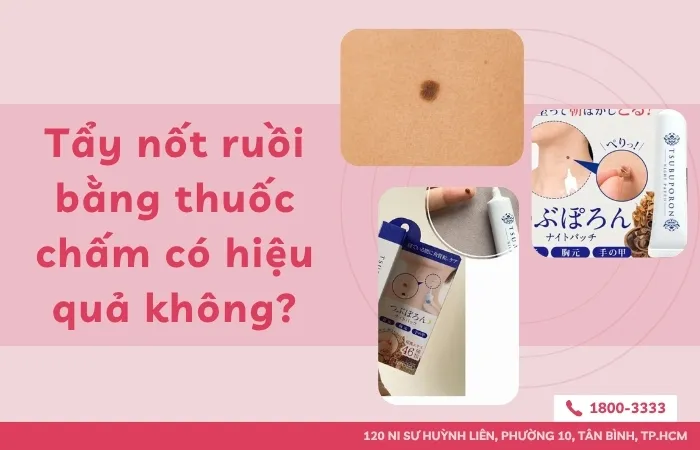 Tẩy nốt ruồi bằng thuốc chấm có hiệu quả không? 5 loại thuốc tẩy nốt ruồi chất lượng
