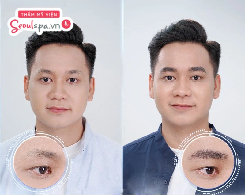 Điêu khắc chân mày là phương pháp sử dụng mực xăm để tạo dáng chân mày sắc nét và đều màu hơn