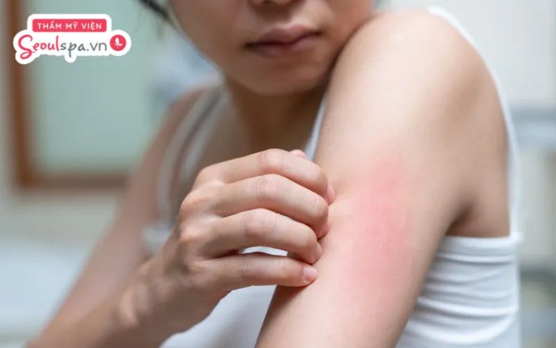 Thực hiện triệt lông khi đến tháng có thể khiến da dễ phản ứng mạnh với nhiệt độ và xuất hiện cảm giác châm chích, nóng rát