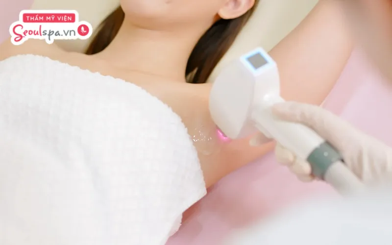 Trong trường hợp cần thực hiện triệt lông trong kỳ kinh nguyệt, bạn nên ưu tiên chọn ngày ít hành kinh để giảm cảm giác khó chịu
