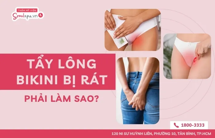 Tẩy lông bikini bị rát phải làm sao? Cách ngừa đau rát hiệu quả