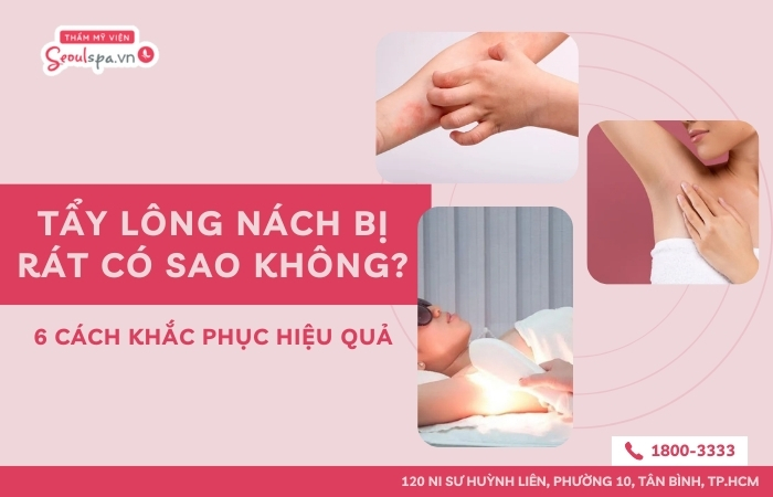 Tẩy lông nách bị rát có sao không? 6 cách khắc phục hiệu quả