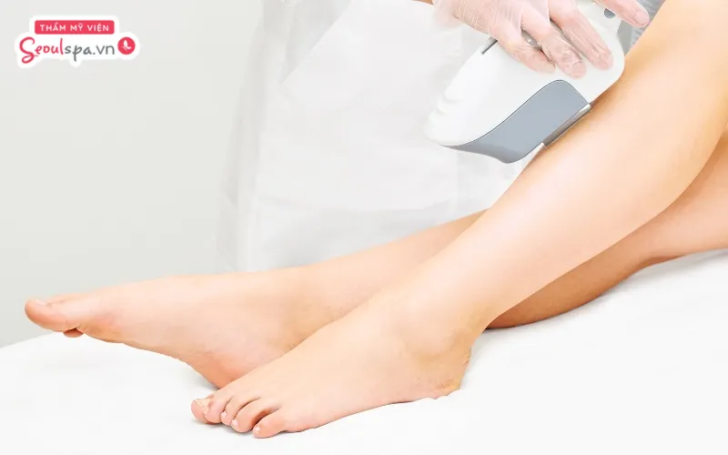 Chọn thời điểm triệt lông phù hợp khi da không có tổn thương hở là cách giảm thiểu nguy cơ kích ứng sau khi triệt lông