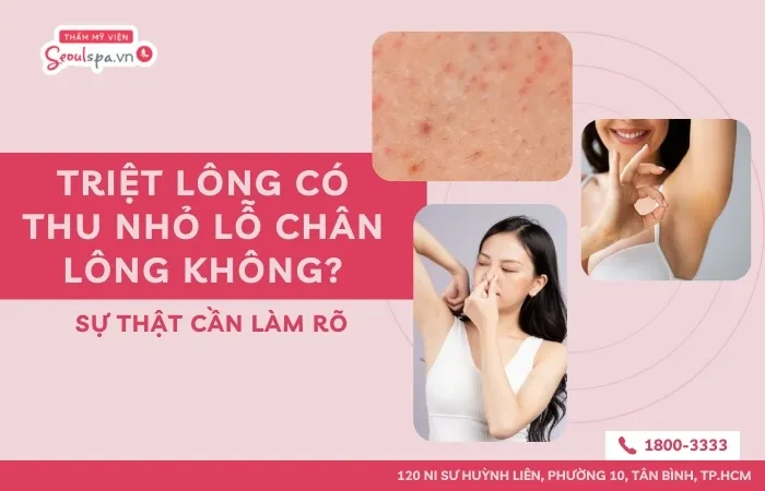 Triệt lông có thu nhỏ lỗ chân lông không? Sự thật cần làm rõ