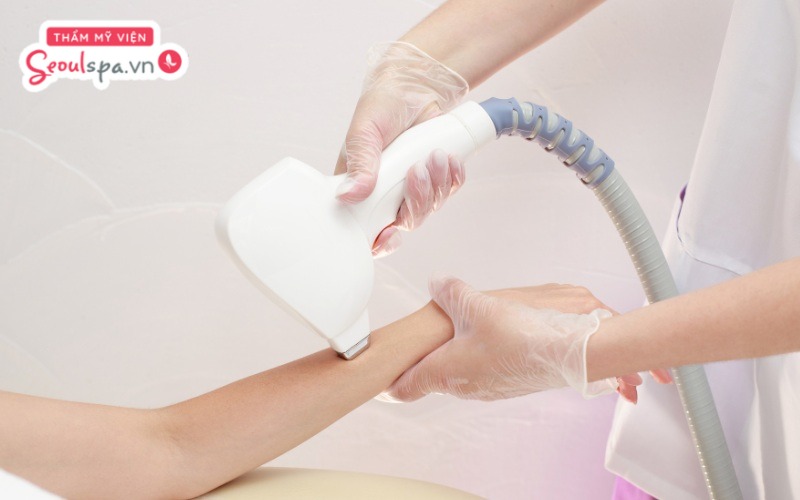 Triệt lông Laser tại spa là giải pháp loại bỏ lông công nghệ cao giúp đem lại hiệu quả triệt lông an toàn và lâu dài