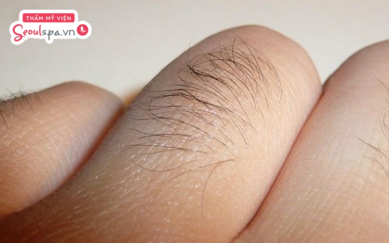 Lông ngón tay có vai trò giúp da dễ thoát hơi nước qua lỗ chân lông và tăng cường khả năng hấp dẫn sinh học