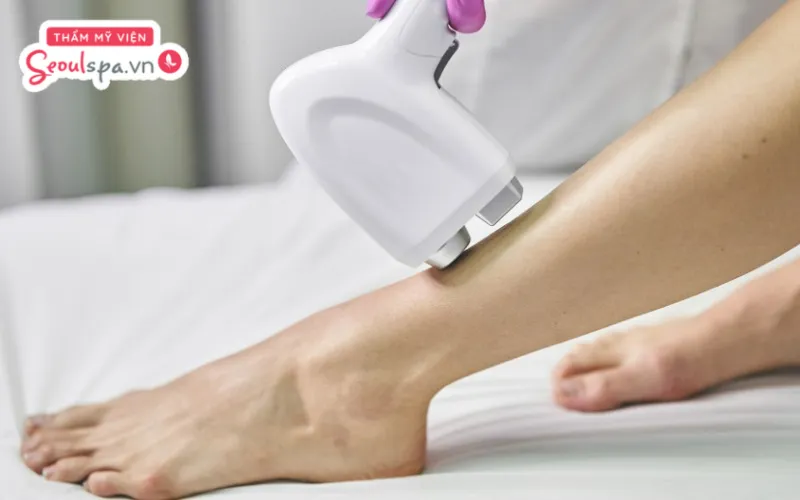 Triệt lông ở spa 1 lần có hết không? Chuyên gia cho rằng triệt lông không đem lại hiệu quả triệt để chỉ sau 1 lần thực hiện