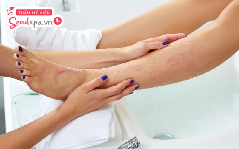 Tẩy tế bào chết chân trước khi thực hiện cạo lông chân sẽ giúp giảm thiểu nguy cơ viêm nhiễm trên da sau khi cạo